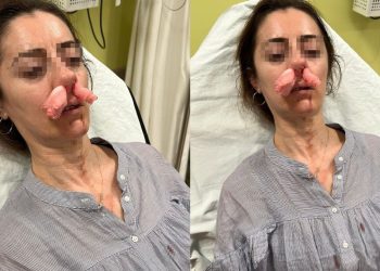 Kocasının sevgilisine benzettiği kadını darbetti, pardon deyip kaçtı