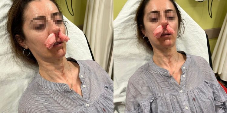 Kocasının sevgilisine benzettiği kadını darbetti, pardon deyip kaçtı