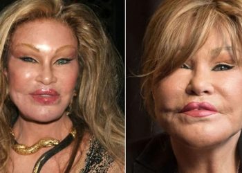 Servetini estetikle eriten ‘Kedi Kadın’ hayatını kaybetti