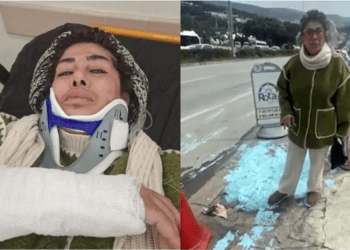 Kaldırıma dökülen yağlı boya hastanelik etti