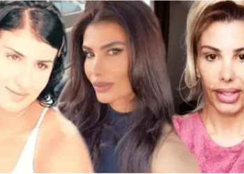 Dişçiye botoks yaptıran türkücü Hatice botokstan zehirlendi!