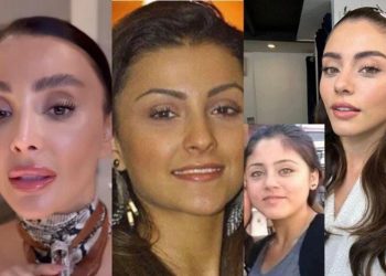 Bu sene en çok onlar paraya kıydı! 2023 yılında estetikleri çok konuşulan ünlüler