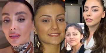 Bu sene en çok onlar paraya kıydı! 2023 yılında estetikleri çok konuşulan ünlüler