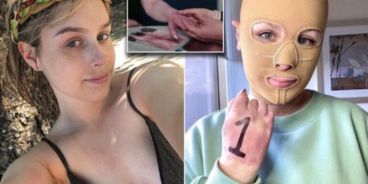 Hayatı saniyeler içinde değişti: Artık sürekli maske takmak zorunda