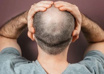 Kelleri sevindiren protein tedavisi: Saç ekimi tarihe karışacak