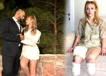 Evlilik yıl dönümünde bacaklarını kaybetti