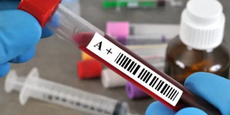 A Rh+ kan grubuna sahip olanları ilgilendiriyor: Yorgun hissetmenizin sebebi ve çaresi buymuş