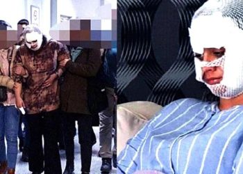 “Seni Bergen gibi yapacağım” dedi, yüzümü paramparça etti!