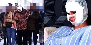 “Seni Bergen gibi yapacağım” dedi, yüzümü paramparça etti!